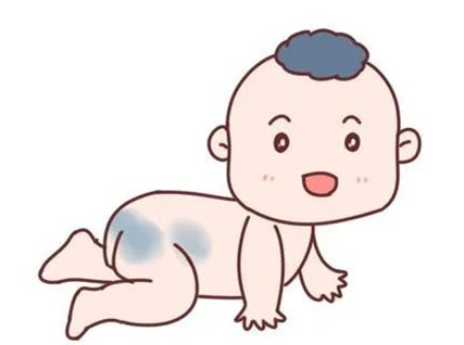 济南哪家医院看小孩胎记好