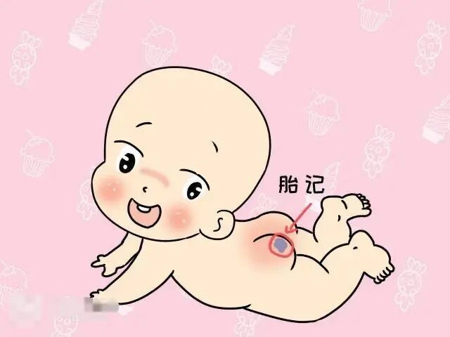 济南哪家医院治疗胎记比较好