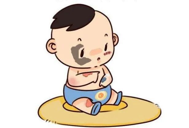 济南治疗幼儿胎记的医院哪里好
