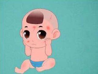 济南哪个医院看血管瘤比较好