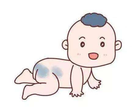 看血管瘤济南哪个医院好