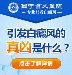南宁上林白癜风皮肤治疗:白斑如何护理?