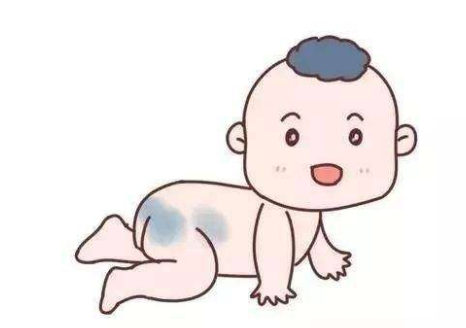 济南哪个医院治疗胎记比较好