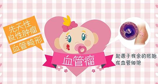 济南治疗婴幼儿血管瘤的医院排行