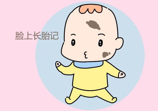 济南青胎记哪里治疗的好