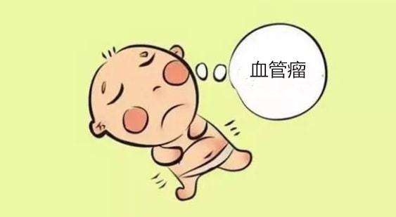 济南治疗血管瘤哪个医院好？了解血管瘤的一些早期症状？