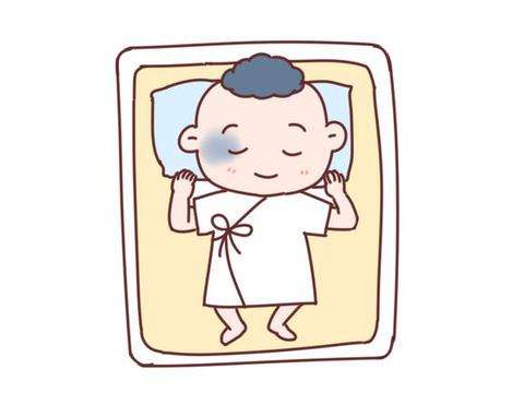 济南哪个医院祛青胎记好