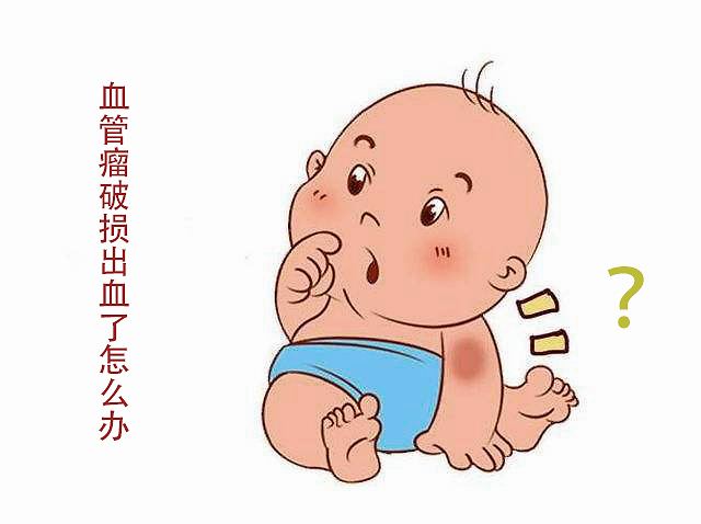 小孩血管瘤去济南哪个医院治疗