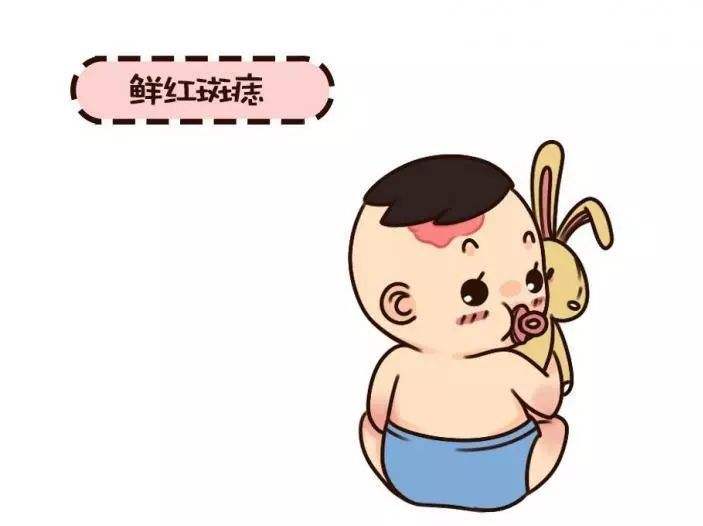 济南治疗鲜红斑痣的医院在哪里？