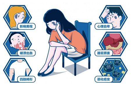 济南胎记手术哪家医院好？没有及时治疗会有什么危害?