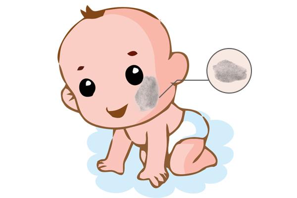 济南治疗太田痣哪个医院好