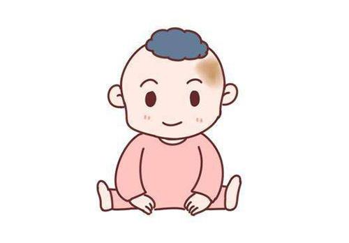 济南正规胎记医院？婴儿胎记去除后会复发吗？