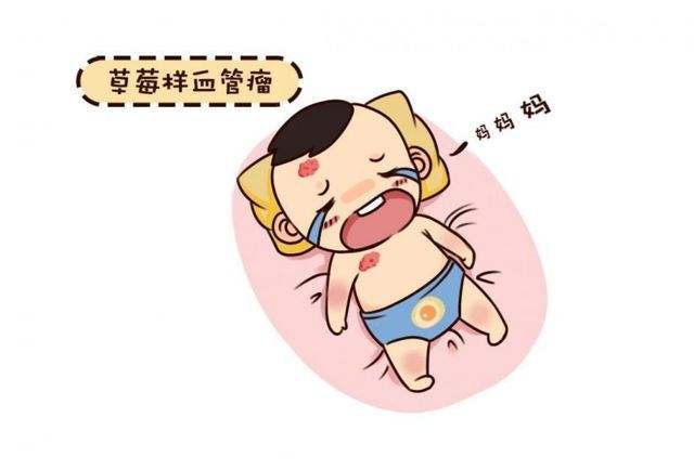 济南什么地方可以治血管瘤