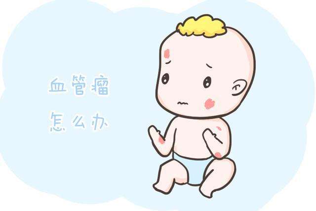 济南哪个医院可以看血管瘤