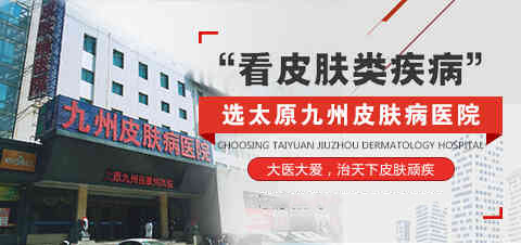 太原专业的皮肤医院在哪_芦荟胶能去痘印吗