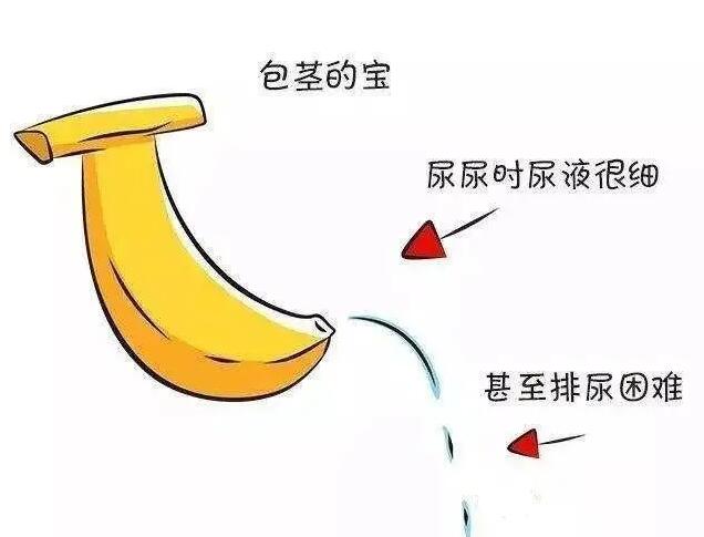 成都看男科哪个医院好