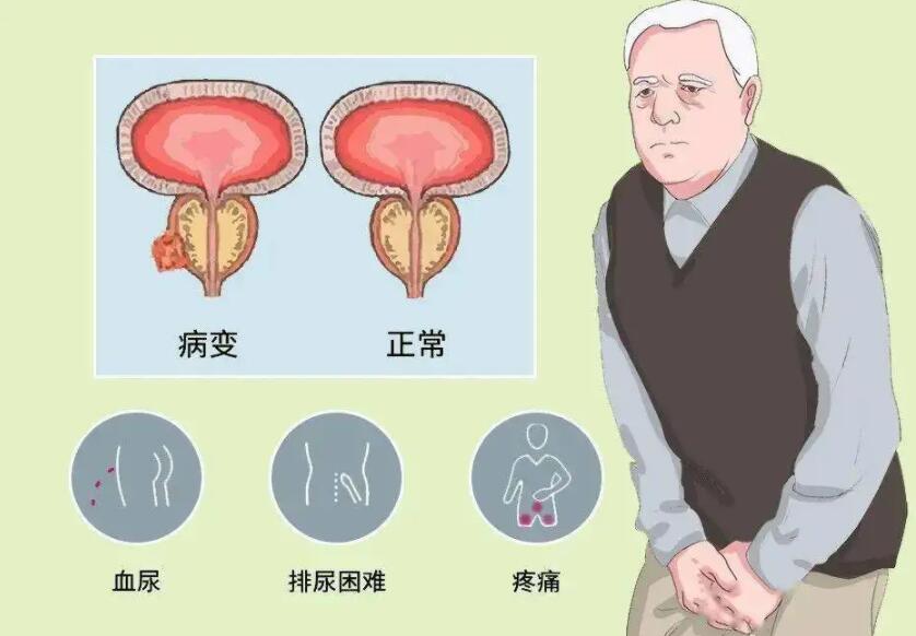成都郫县男性专科医院那家好