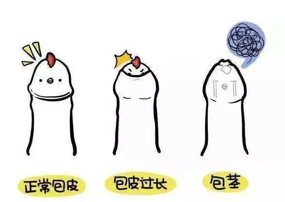成都高新区比较好的阳痿医院