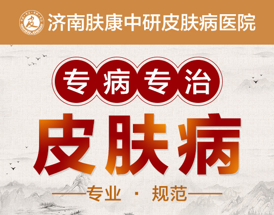 济南皮肤病医院哪家看皮肤科_济南治皮肤病哪医院好