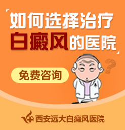 治疗好的白癜风又复发了应该咋办?陕西哪家白癜风医院比较好