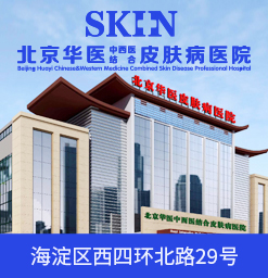 产生牛皮癣的原因是什么?