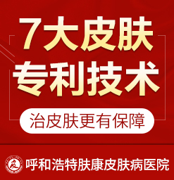 呼和浩特治疗过敏性皮炎的医院_在呼市治湿疹哪家医院好