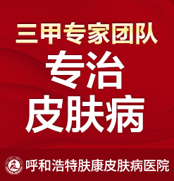 呼和浩特过敏性皮炎治疗好医院_呼市哪个医院湿疹治的好