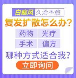 白癜风的出现该咋正确的治疗?陕西哪里能看白癜风