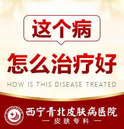 西宁哪家专科医院治脱发好_西宁治疗脱发较好的医院