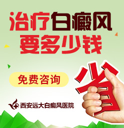 大面积的白癜风怎样治疗好?西安白癜风医学研究院
