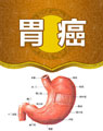 中醫(yī)治療胃癌