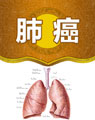 中醫(yī)治療肺癌