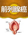 中醫(yī)治療前列腺癌