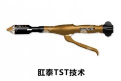 TST智能吻合微創技術