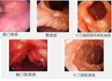 成都胃腸病醫(yī)院